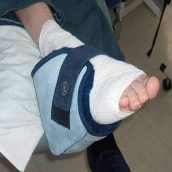 Sheepskin Heel Protectors (Large) – Sheepskin & Skin Protectors | Coastcare Medical