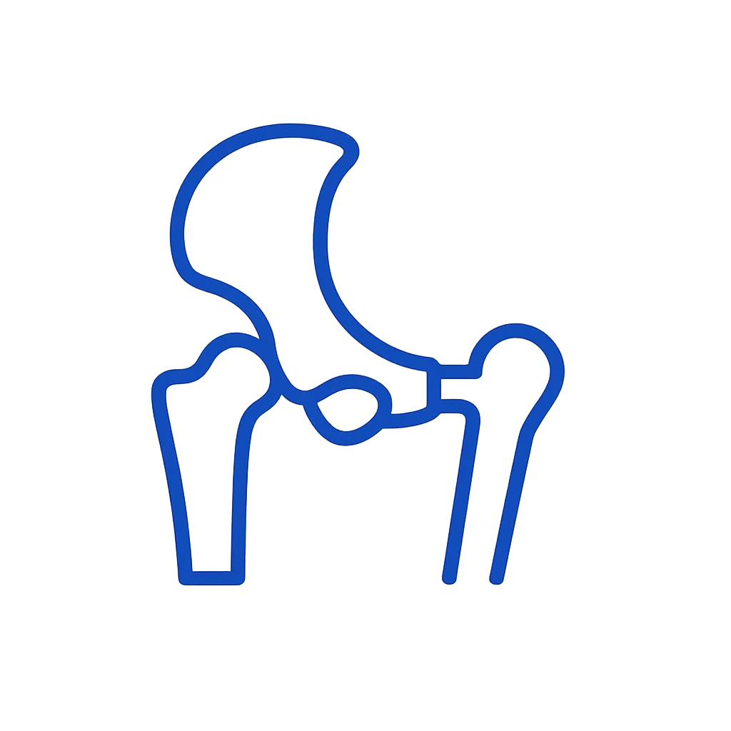 Hip Replacement