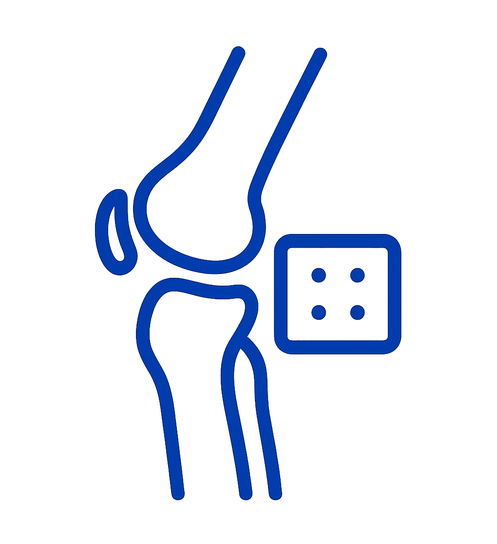 Knee Replacement