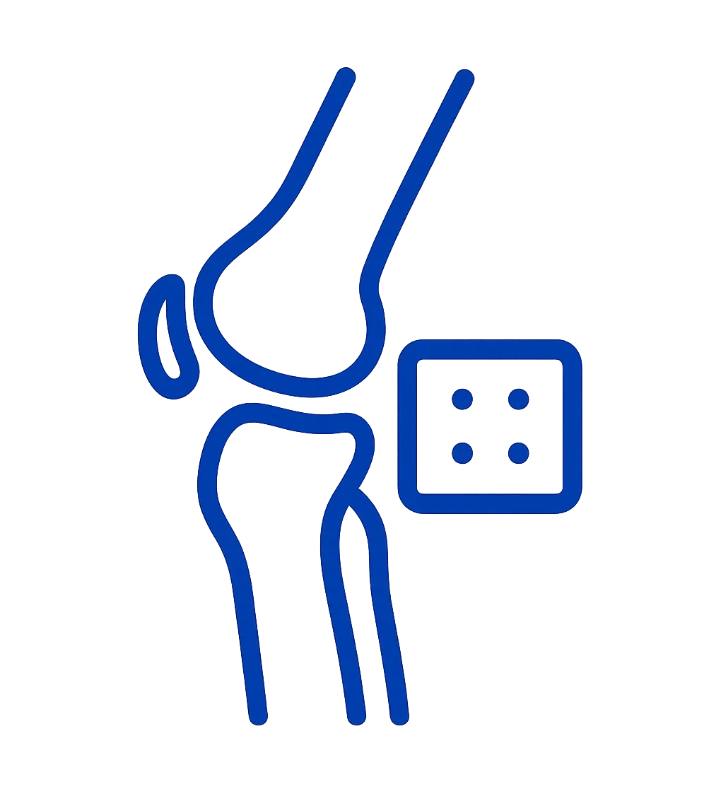 Knee Replacement